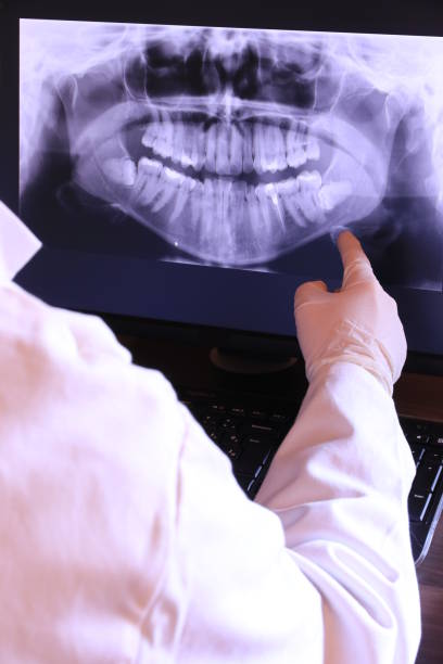 Best Knocked-Out Tooth (Avulsed Tooth) Treatment in Center Line, MI