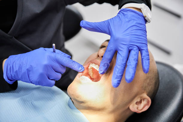 Best Emergency Root Canal Therapy in Center Line, MI